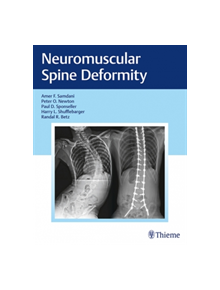 Neuromuscular Spine Deformity - 9781626232600