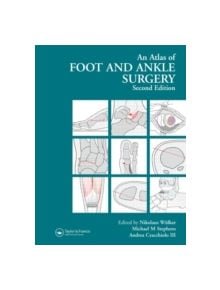 Atlas Foot and Ankle Surgery - 9781841841953