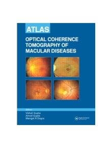 Atlas of Optical Coherence Tomography of Macular Diseases - 9781841844688