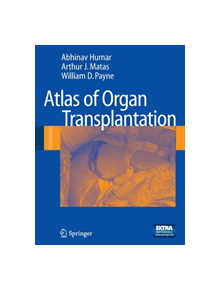 Atlas of Organ Transplantation - 9781848009141