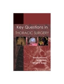 Key Questions in Thoracic Surgery - 9781903378861