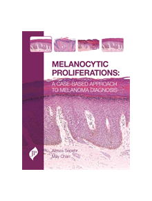 Melanocytic Proliferations - 9781907816970