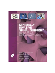 Minimally Invasive Spinal Surgery - 9781909836105