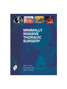 Minimally Invasive Thoracic Surgery - 9781909836402