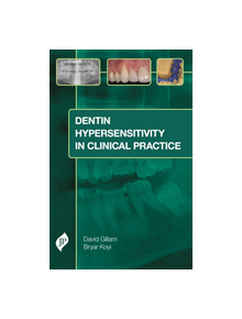 Dentin Hypersensitivity in Clinical Practice - 9781909836471