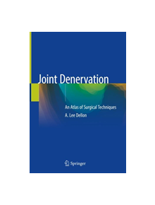 Joint Denervation - 9783030055370