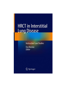 HRCT in Interstitial Lung Disease - 9783030163143