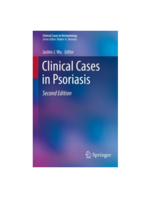 Clinical Cases in Psoriasis - 9783030187712