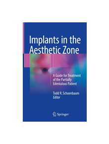 Implants in the Aesthetic Zone - 9783319726007