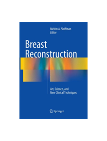 Breast Reconstruction - 9783319792569