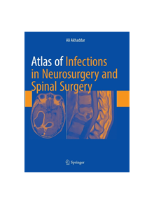 Atlas of Infections in Neurosurgery and Spinal Surgery - 9783319867731