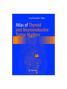 Atlas of Thyroid and Neuroendocrine Tumor Markers - 9783319873305