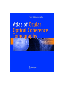 Atlas of Ocular Optical Coherence Tomography - 9783319883144