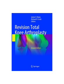 Revision Total Knee Arthroplasty - 9783319884165