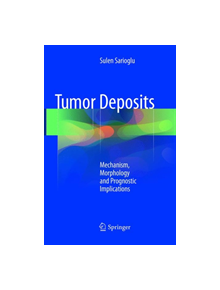 Tumor Deposits - 9783319886244