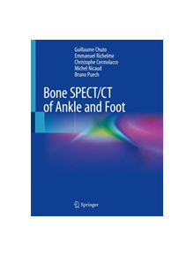 Bone SPECT/CT of Ankle and Foot - 9783319908106