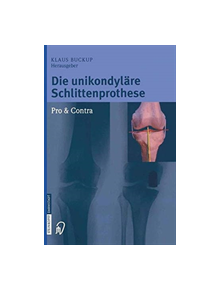 Die unikondylare Schlittenprothese Pro & Contra - 9783642621710