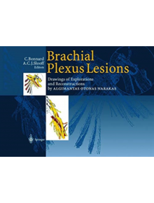 Brachial Plexus Lesions - 9783642635632