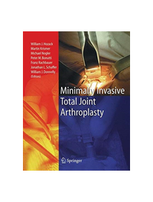 Minimally Invasive Total Joint Arthroplasty - 9783642639265