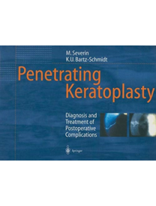 Penetrating Keratoplasty - 9783642640834