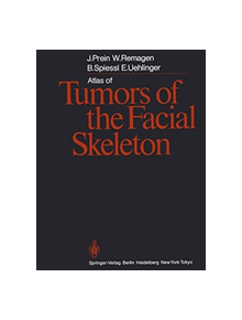 Atlas of Tumors of the Facial Skeleton - 9783642709517