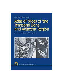 Atlas of Slices of the Temporal Bone and Adjacent Region - 9783642805189