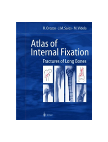 Atlas of Internal Fixation - 9783662058954