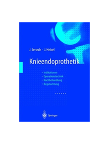 Knieendoprothetik - 9783662081235