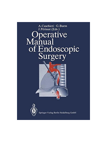 Operative Manual of Endoscopic Surgery - 9783662222591