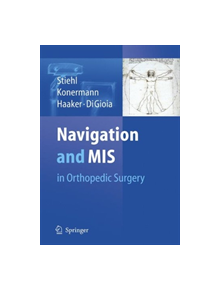 Navigation and MIS in Orthopedic Surgery - 9783662500729