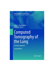 Computed Tomography of the Lung - 9783662568637