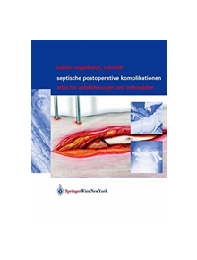 Septische postoperative Komplikationen - 9783709172926