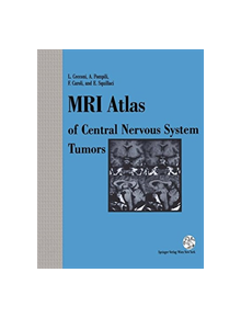 MRI Atlas of Central Nervous System Tumors - 9783709191804