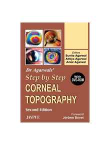 Dr Agarwal's Step by Step (R) Corneal Topography - 9788180617508