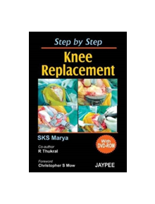 Step by Step Knee Replacement - 9788180619229