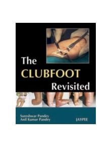 The Club Foot Revisited - 9788184484359