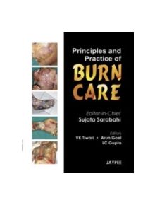 Principles and Practice of Burn Care - 9788184488098