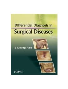 Differential Diagnosis in Surgical Diseases - 9788184489026