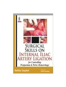 Surgical Skills on Internal Iliac Artery Ligation for Controlling Postpartum and Pelvic Hemorrhage - 9789350253786