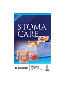 Stoma Care - 9789352704873