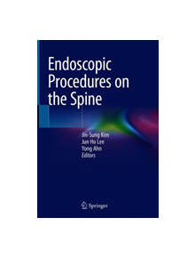 Endoscopic Procedures on the Spine - 9789811039041