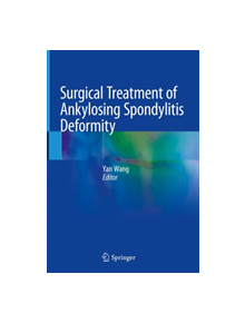 Surgical Treatment of Ankylosing Spondylitis Deformity - 9789811364266