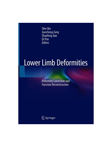 Lower Limb Deformities - 9789811396038