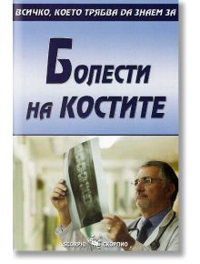 Всичко, което трябва да знаем за: Болести на костите - Александра Танева - Скорпио - 9789547921788